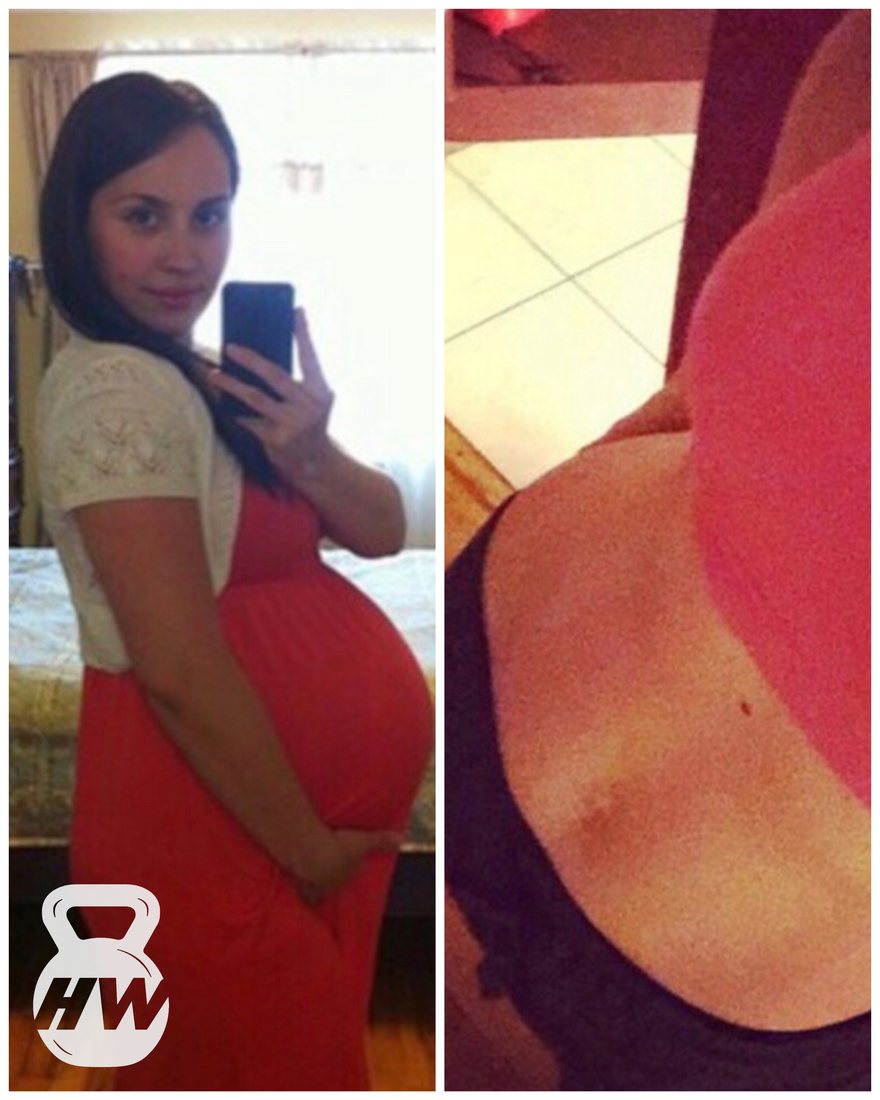 Before and after photos of a client's postpartum body transformation